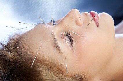 acupuncture facelift Chichester West Sussex