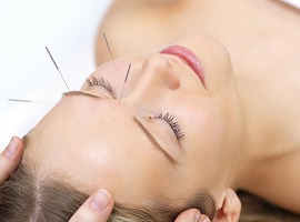 acupuncture facelift Chichester West Sussex