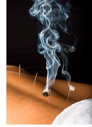 acupuncture treatments Chichester West Sussex